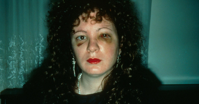 Rendez-vous photo - Nan Goldin, le combat dans l’oeil