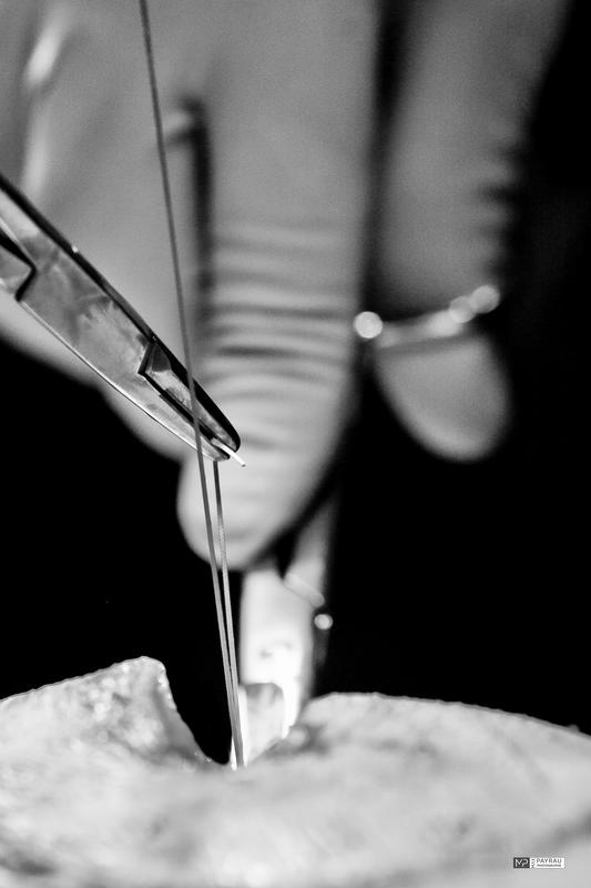 Exposition Photographies "Chirurgie "